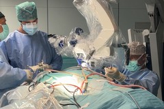 Intervento mini-invasivo al Policlinico di Bari: rimosso un tumore al cervello senza incisioni
