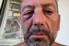 Runner colpito all'occhio da un uovo scagliato da un'auto sul lungomare di Bari