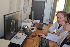 Al "Bonomo" di Andria un farmaco innovativo per il trattamento dell'ictus utilizzato con successo in Neurologia