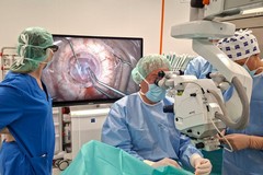 Eseguiti al Policlinico di Bari i primi trapianti di cornea con endotelio sintetico