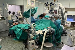 Operazione chirurgica innovativa al Policlinico di Bari: rimosso tumore a una falange