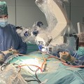 Intervento mini-invasivo al Policlinico di Bari: rimosso un tumore al cervello senza incisioni