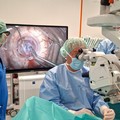 Eseguiti al Policlinico di Bari i primi trapianti di cornea con endotelio sintetico