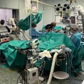 Operazione chirurgica innovativa al Policlinico di Bari: rimosso tumore a una falange